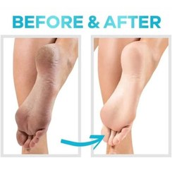 کرم رفع ترک پا - برند کامان حجم 230 میلی لیتر