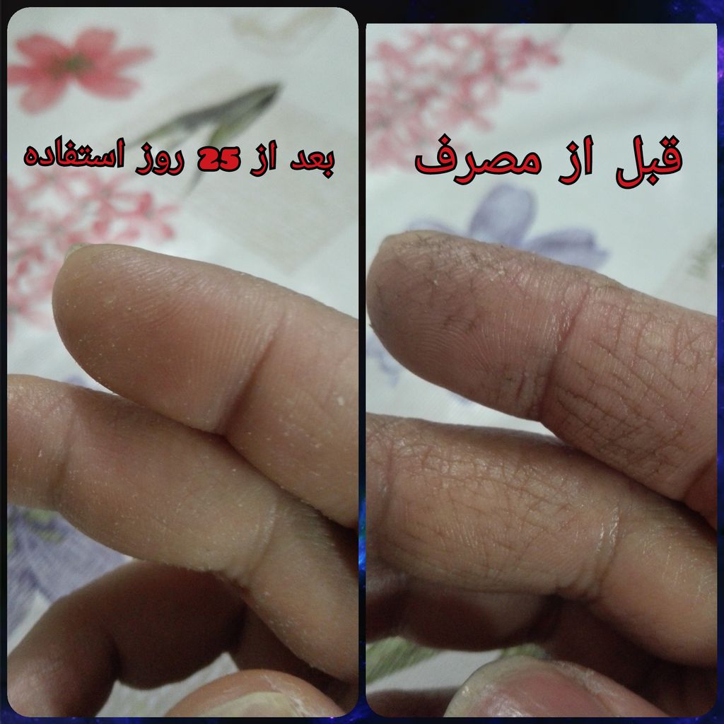 کرم مرطوب کننده صورت و بدن کامان مدل عسل مخصوص پوست خشک، حاوی شی‌باتر، موم زنبور عسل و وازلین، حجم 400 میلی‌لیتر