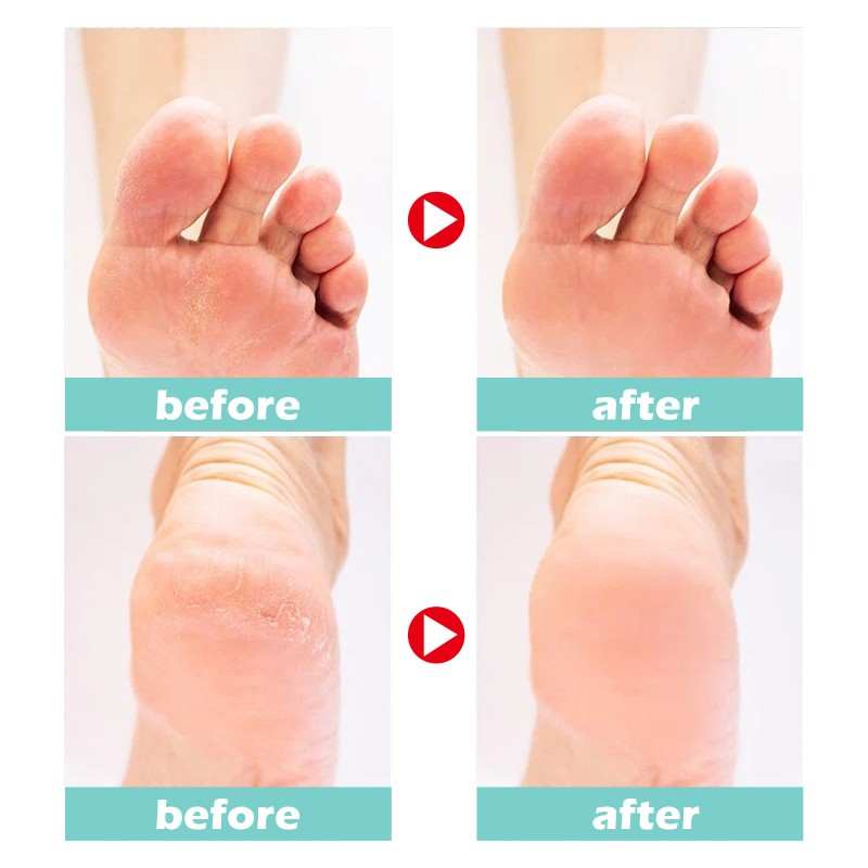 کرم رفع ترک پا - برند کامان حجم 230 میلی لیتر